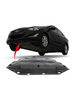 Engine Splash Shield for Hyundai Elantra 2014-2016