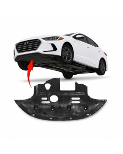 Engine Splash Shield for Hyundai Elantra 2017-2020